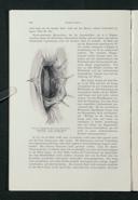 Seite 